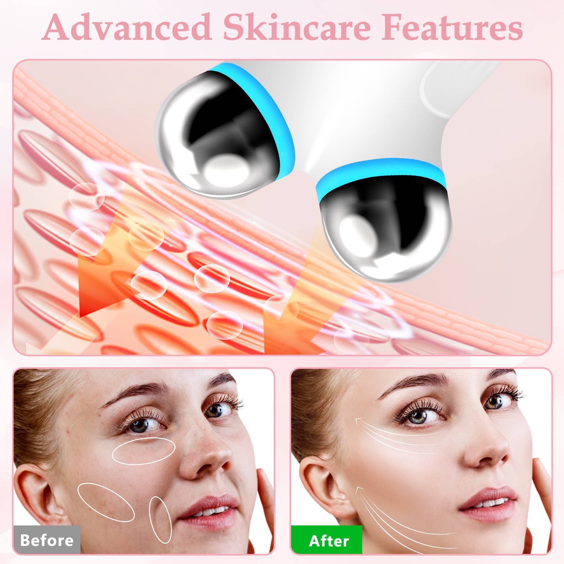 Anti Aging Facial Device